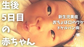 黄疸 Youtube