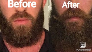 Beard Growth: How to grow a beard fast naturally at home