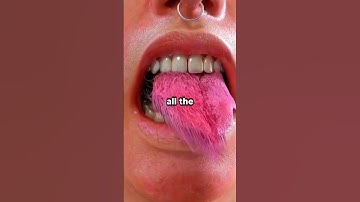 What Is Something Considered Socially Acceptable If You Are Conventionally Attractive But Is Not ...