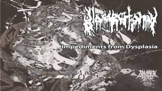 Download Lagu Glossectomy - Impediments From Dysplasia (2014) {Full-EP} MP3