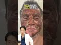 【ピーリング】皮向けやばい！どのくらい肌が綺麗になる！？ #shorts