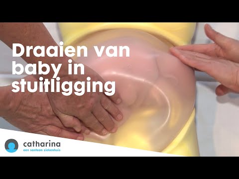 Video: Kunt U Uw Transversale Baby Laten Draaien?