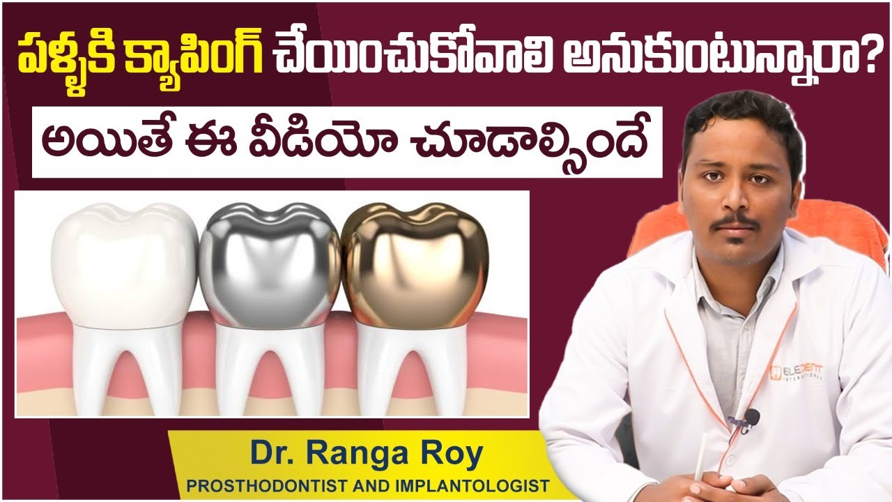 పంటి క్యాపింగ్ Types of Teeth Caps in Telugu Dental Caps Side
