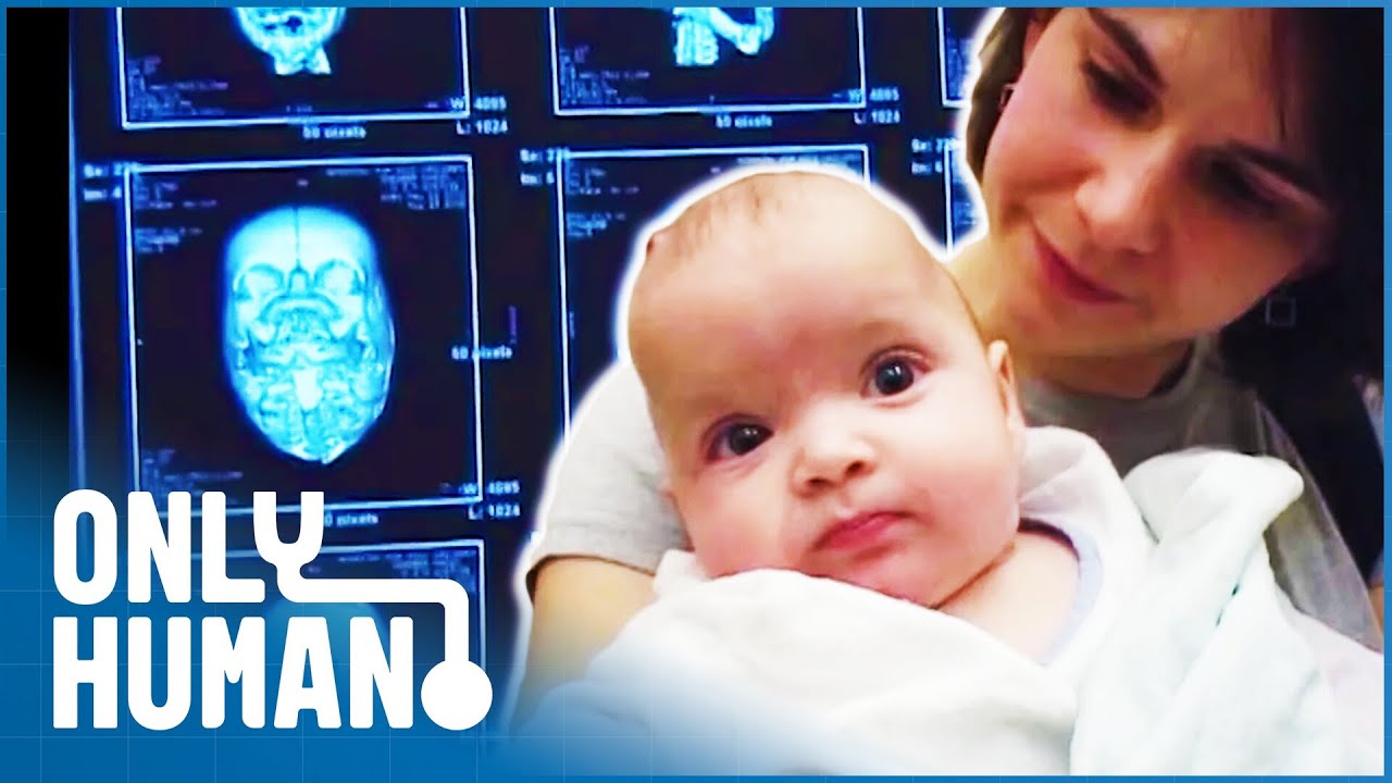Baby Twin's Skull Reconstruction | Life's Little Miracles | Only Human