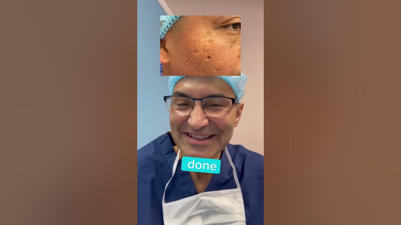 CHICKEN POX SCARS - DR. TANVEER JANJUA - NEW JERSEY