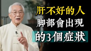 肝有問題了，腳部往往會出現3個症狀！可能是肝硬化或癌的徵兆，很多人卻還不知道。