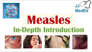 Introduction to Measles | Causes, Risk Factors, Transmission, Stages of Infection, Signs & Symptoms