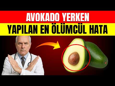 Avokado Yiyin ama