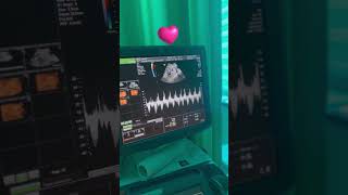 Dr.leyla Aliyeva Ilə Hamiləlik Müayinəniz