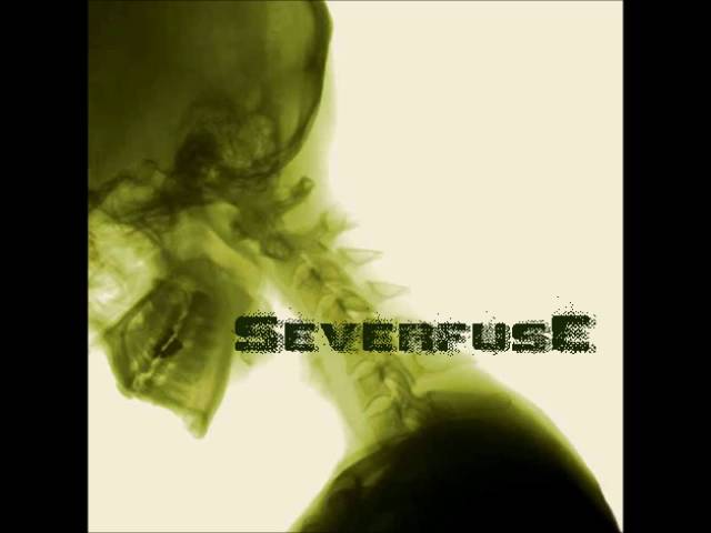 Watch Severfuse - Over You on YouTube Watch Severfuse - Over You on YouTube
