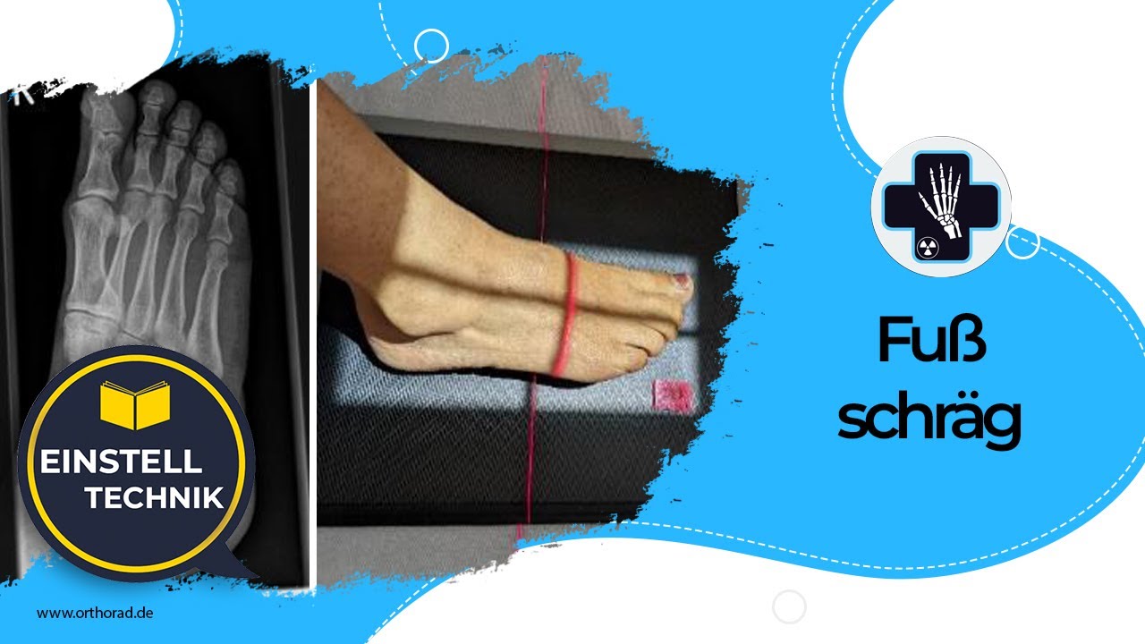 Röntgen Fuß schräg / seitlich - YouTube