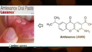 #amlexanox #oral #paste #mouth ulcer #medicine #english #education #knowledge #drugs