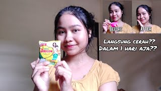 CARA MEMUTIHKAN WAJAH SECARA ALAMI DENGAN CEPAT || MASKER SUSU DANCOW