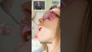 Dyk Laser Tongue- Tie Surgery?