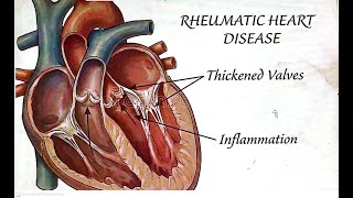 Quick End of Semester Revision  CVS