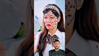 Tiny Ants Inside Her Mouth! 😱 You Won’t Believe This #creepy #ants #satisfying #viralvideo