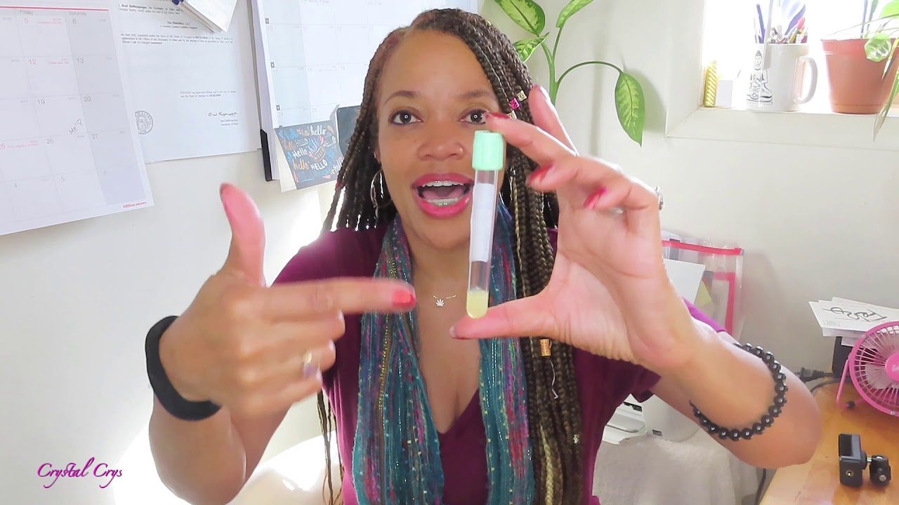 PHLEBOTOMY - SERUM  -VS- PLASMA (TUBES) 