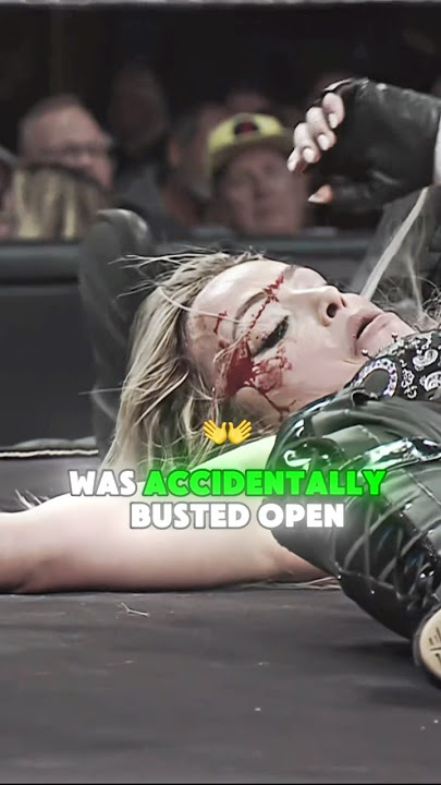 Liv Morgan GOT BRUTALLY BUSTED OPEN 🤯