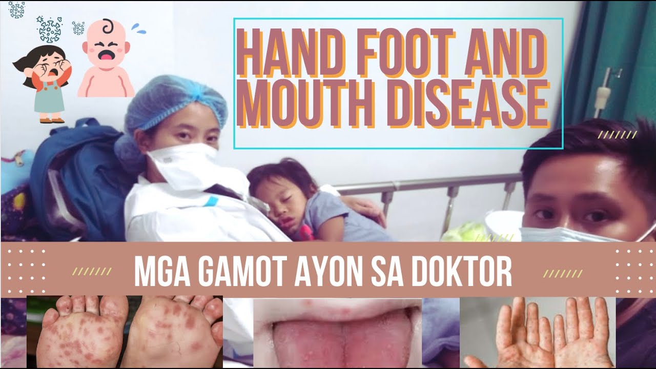 Hand Foot and Mouth Disease Gamot ayon sa doktor Emergency!! YouTube