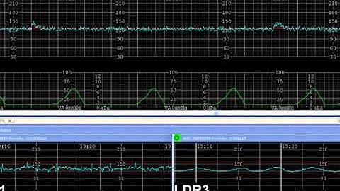 E Tools Demo : OBIX Perinatal Data System by Clinical Computer Systems INC. (CCSI)
