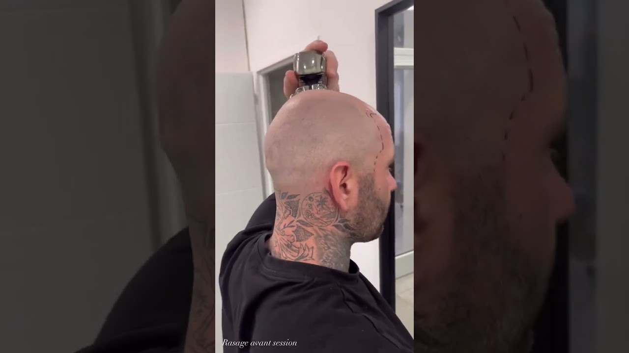 Le Rasoir indispensable des professionnels de la tricopigmentation 