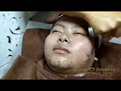 DERMABEAUTEE TREATMENT : DETOX + ACNE MASK