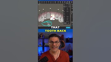 How to make teeth unmovable in the Invisalign ClinCheck software?