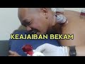 Kolesterol Tinggi Membuat Seluruh Badan Tidak enak, alhamdulillah dengan bekam hilang seketika