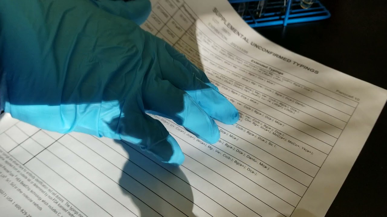 Blood Banking Prenatal Workup Antibody Titer Part 2 YouTube