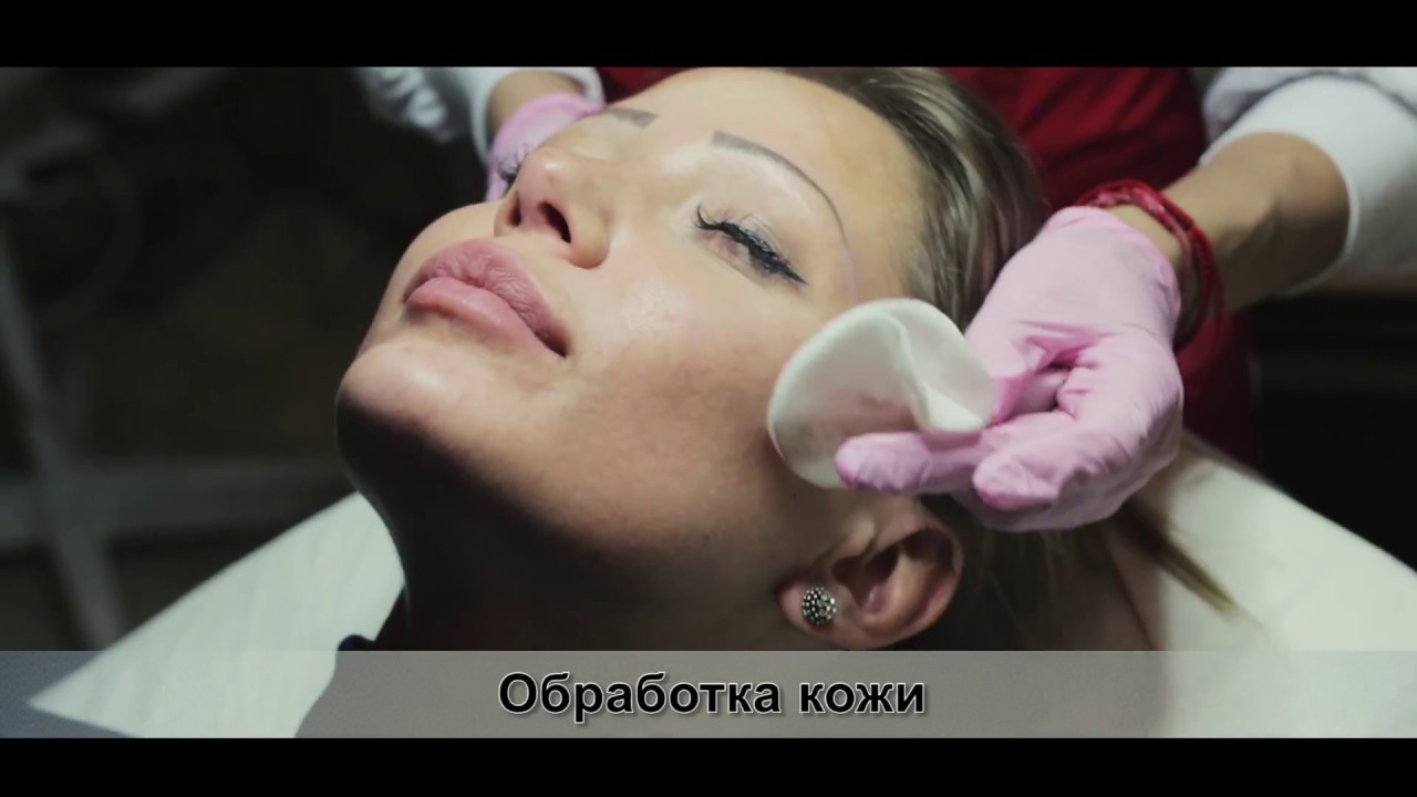 Коррекция и увеличение скул