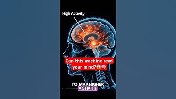How fMRI works! Simply explained #brainimaging #fmri #mindreading #brainhealth #mri #humanbrain
