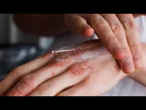 Video: Cum să preveniți crăparea pielii sintetice: 10 pași