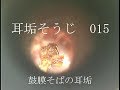 耳垢そうじ/耳閉感を伴う鼓膜に付着した耳垢/015