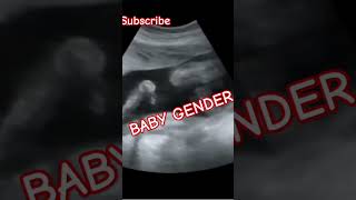 ULTRASOUND BABY BOY GENDER SCAN