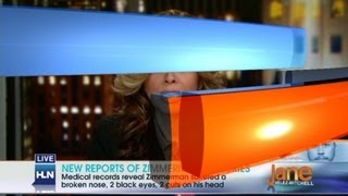 New Report Details Zimmermans Injuries