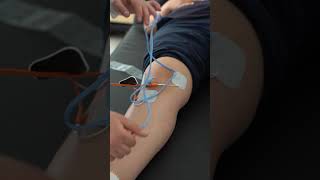 Close-up electrotherapy on leg for muscle rehab.#physiotherapy #electrotherapy
