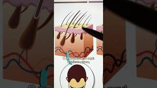 Shampoo para tratar a calvície