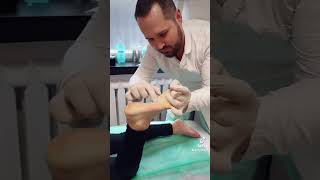 Foot Correction Next