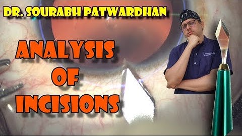 Analysis of phaco Incisions- type, indication, astigmatism: Thought process - Dr Sourabh Patwardhan