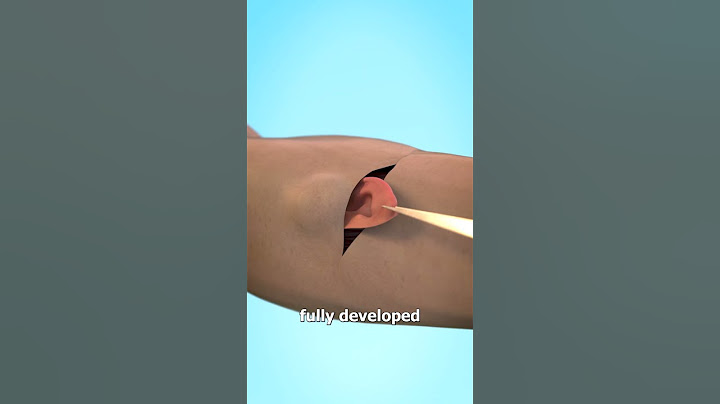 Growing An Ear In Your Arm 😨