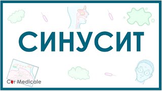 Синусит: механизм развития, симптомы, диагностика, лечение - кратко