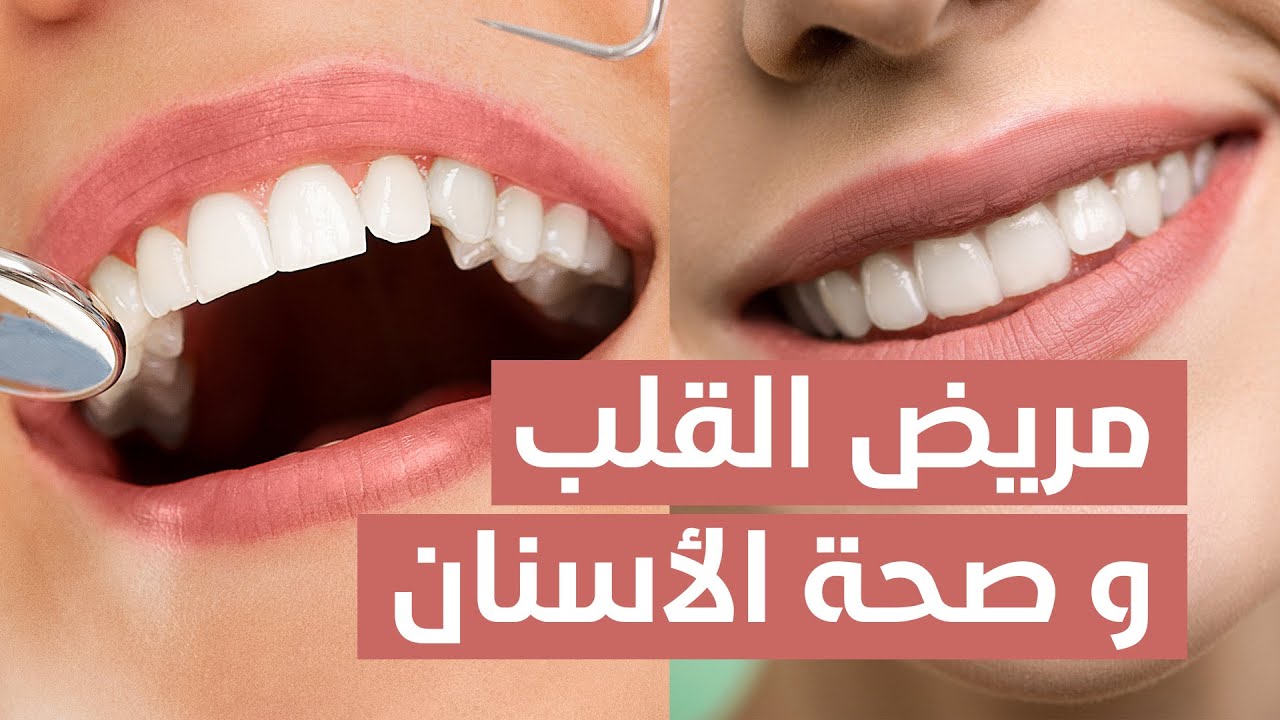 مريض القلب وصحة الفم والأسنان