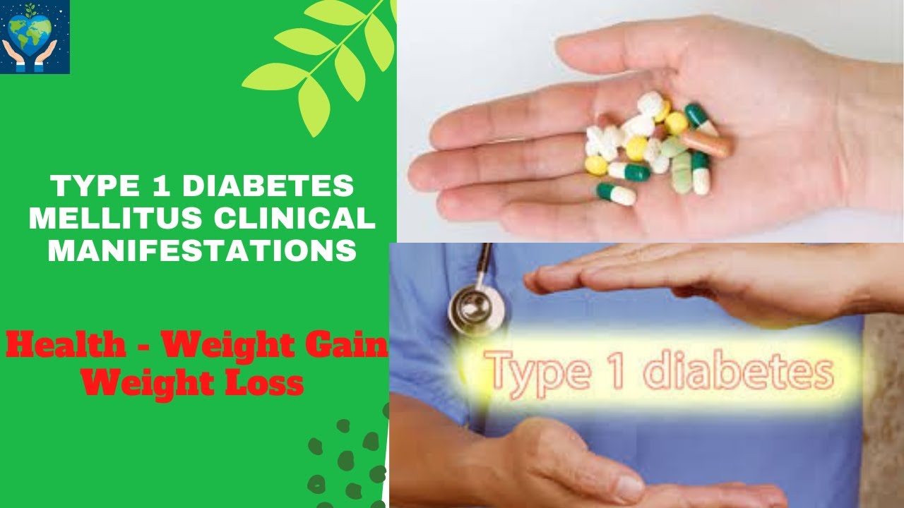 Health Weight Gain Weight Loss Type 1 diabetes mellitus clinical