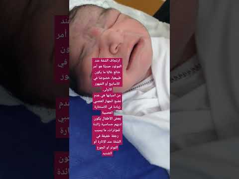 اسباب ارتجاف الشفة عند البكاء في حديثي الولادة    أمومة