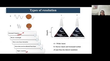 Image optimization and knobology,Speaker Dr Gegal Purthi, Moderator Dr Sushmit Kamat, 12th Jan 2025