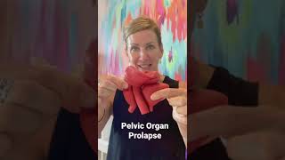 Pelvic Organ Prolapse Explained Visually #shorts