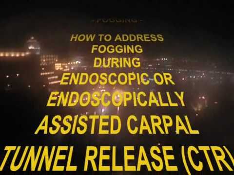 -FOGGING - How to Address Fogging During Endoscopic Carpal Tunnel Release.wmv