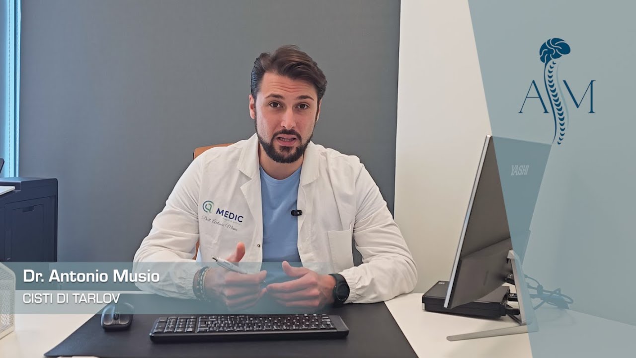 Cisti di Tarlov - Dott. Antonio Musio #neurochirurgo #cistiditarlov