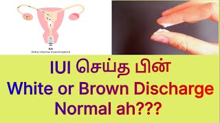IUI செய்த பின் White Discharge or Brown Discharge Normal ah?? Reasons for White discharge after IUI screenshot 3