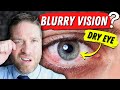 Gambar cover Why Dry Eyes Cause Blurry Vision - 3 Reasons, And 3 Home Remedies